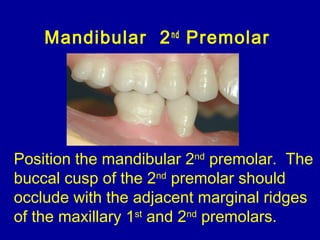 Mandibular 2nd
Premolar
Position the mandibular 2nd
premolar. The
buccal cusp of the 2nd
premolar should
occlude with the adjacent marginal ridges
of the maxillary 1st
and 2nd
premolars.
 
