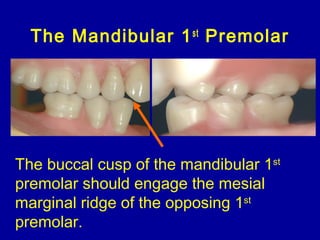 The Mandibular 1st
Premolar
The buccal cusp of the mandibular 1st
premolar should engage the mesial
marginal ridge of the opposing 1st
premolar.
 