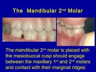 The Mandibular 2nd
Molar
The mandibular 2nd
molar is placed with
the mesiobuccal cusp should engage
between the maxillary 1st
and 2nd
molars
and contact with their marginal ridges.
 