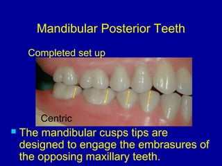 Mandibular Posterior Teeth
 The mandibular cusps tips are
designed to engage the embrasures of
the opposing maxillary teeth.
Completed set up
Centric
 