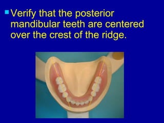  Verify that the posterior
mandibular teeth are centered
over the crest of the ridge.
 