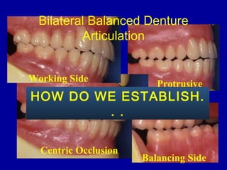 Balancing Side
Protrusive
Centric Occlusion
Bilateral Balanced Denture
Articulation
Working Side
HOW DO WE ESTABLISH.
. .
 