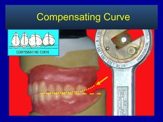 Compensating Curve
 