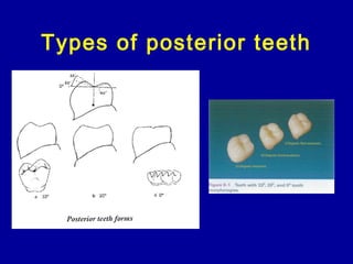 Types of posterior teeth
 