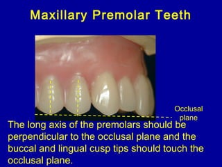 The long axis of the premolars should be
perpendicular to the occlusal plane and the
buccal and lingual cusp tips should touch the
occlusal plane.
Maxillary Premolar Teeth
Occlusal
plane
 