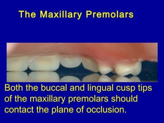 Both the buccal and lingual cusp tips
of the maxillary premolars should
contact the plane of occlusion.
The Maxillary Premolars
 