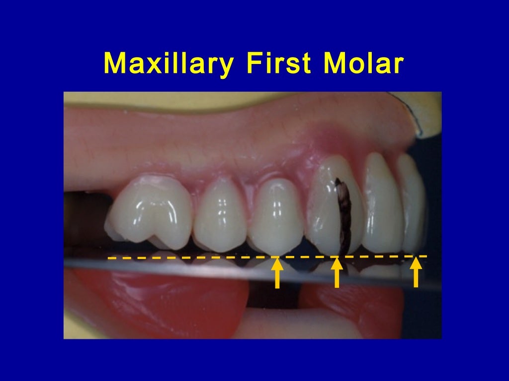 10. posterior teeth arrangement