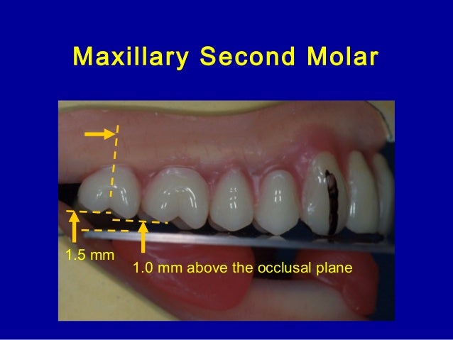 teeth setting