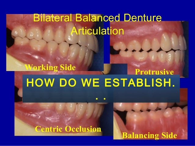 10 posterior teeth arrangement compensating curve