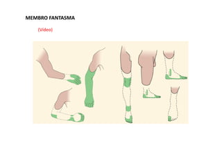 MEMBRO FANTASMA
(Vídeo)
 