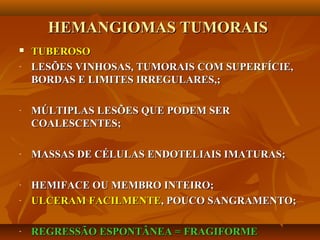 HEMANGIOMAS TUMORAISHEMANGIOMAS TUMORAIS
 TUBEROSOTUBEROSO
- LESÕES VINHOSAS, TUMORAIS COM SUPERFÍCIE,LESÕES VINHOSAS, TUMORAIS COM SUPERFÍCIE,
BORDAS E LIMITES IRREGULARES,;BORDAS E LIMITES IRREGULARES,;
- MÚLTIPLAS LESÕES QUE PODEM SERMÚLTIPLAS LESÕES QUE PODEM SER
COALESCENTES;COALESCENTES;
- MASSAS DE CÉLULAS ENDOTELIAIS IMATURAS;MASSAS DE CÉLULAS ENDOTELIAIS IMATURAS;
- HEMIFACE OU MEMBRO INTEIRO;HEMIFACE OU MEMBRO INTEIRO;
- ULCERAM FACILMENTEULCERAM FACILMENTE, POUCO SANGRAMENTO;, POUCO SANGRAMENTO;
- REGRESSÃO ESPONTÂNEA = FRAGIFORMEREGRESSÃO ESPONTÂNEA = FRAGIFORME
 