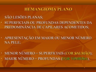 HEMANGIOMA PLANOHEMANGIOMA PLANO
SÃO LESÕES PLANAS;SÃO LESÕES PLANAS;
• SUPERFICIAIS OU PROFUNDAS DEPENDENTES DASUPERFICIAIS OU PROFUNDAS DEPENDENTES DA
PREDOMINÂNCIA DE CAPILARES ACOMETIDOS;PREDOMINÂNCIA DE CAPILARES ACOMETIDOS;
• APRESENTAÇÃO EM MAIOR OU MENOR NÚMEROAPRESENTAÇÃO EM MAIOR OU MENOR NÚMERO
NA PELE;NA PELE;
• MENOR NÚMERO = SUPERFICIAIS (MENOR NÚMERO = SUPERFICIAIS (COR SALMÃOCOR SALMÃO););
• MAIOR NÚMERO = PROFUNDAS (MAIOR NÚMERO = PROFUNDAS (COR VINHOSACOR VINHOSA).).
 