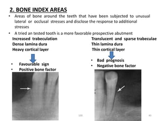 Sparse Teeth Diagnosis and treatment planning for removable partial dentures- Kelly ...