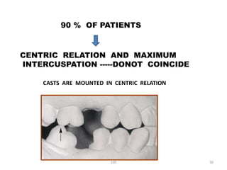 Diagnosis and treatment planning for removable partial dentures- Kelly ...