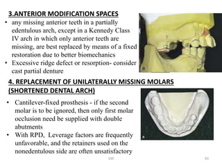 Shortened Rpd Diagnosis and treatment planning for removable partial dentures- Kelly ...