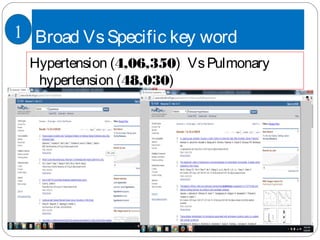 Broad VsSpecific key word
Hypertension (4,06,350) VsPulmonary
hypertension (48,030)
1
 