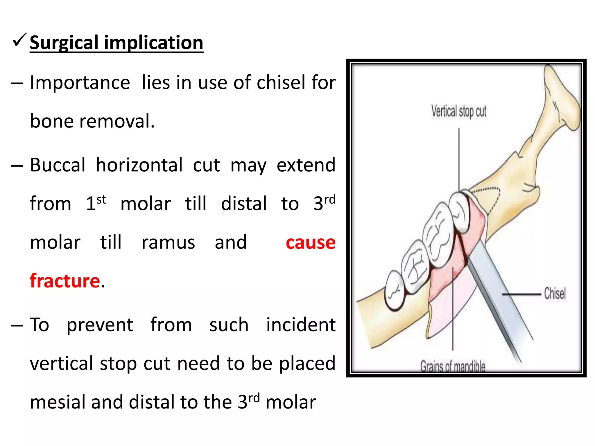 Surgical implication
– Importance lies in use of chisel for
bone removal.
– Buccal horizontal cut may extend
from 1st molar till distal to 3rd
molar till ramus and cause
fracture.
– To prevent from such incident
vertical stop cut need to be placed
mesial and distal to the 3rd molar
 