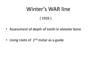 ( 1926 )
• Assessment of depth of tooth in alveolar bone
• Using roots of 2nd molar as a guide
Winter’s WAR line
 