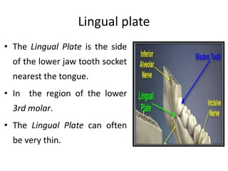 • The Lingual Plate is the side
of the lower jaw tooth socket
nearest the tongue.
• In the region of the lower
3rd molar.
• The Lingual Plate can often
be very thin.
Lingual plate
 