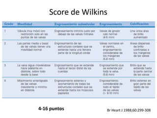 Score de Wilkins
4-16 puntos Br Heart J 1988;60:299-308
 