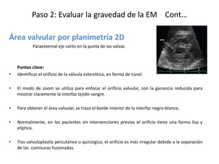 Paso 2: Evaluar la gravedad de la EM Cont…
Área valvular por planimetría 2D
Paraesternal eje corto en la punta de las valvas
Puntos clave:
• Identificar el orificio de la válvula estenótica, en forma de túnel.
• El modo de zoom se utiliza para enfocar el orificio valvular, con la ganancia reducida para
mostrar claramente la interfaz tejido-sangre.
• Para obtener el área valvular, se traza el borde interior de la interfaz negro-blanco.
• Normalmente, en los pacientes sin intervenciones previas el orificio tiene una forma lisa y
elíptica.
• Tras valvuloplastía percutánea o quirúrgica, el orificio es más irregular debido a la separación
de las comisuras fusionadas.
 