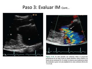 Paso 3: Evaluar IM Cont…
 