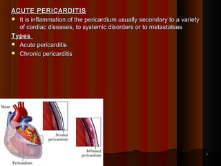10.Diseases of pericardium | PPT