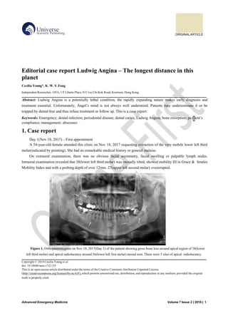 ORIGINALARTICLE
Advanced Emergency Medicine Volume 7 Issue 2 | 2018 | 1
Editorial case report Ludwig Angina – The longest distance in this
planet
Cecilia Young*, K. W. Y.Fong
Independent Researcher, 105A, 1/F Liberte Place, 833 Lai Chi Kok Road, Kowloon, Hong Kong
Abstract: Ludwig Angina is a potentially lethal condition, the rapidly expanding nature makes early diagnosis and
treatment essential. Unfortunately, Angel’s mind is not always well understood. Patients may underestimate it or be
trapped by dental fear and thus refuse treatment or follow up. This is a case report.
Keywords: Emergency; dental infection; periodontal disease; dental caries; Ludwig Angina; bone resorption; pa t ient’s
compliance; management; abscesses
1. Case report
Day 1(Nov 18, 2017) – First appointment
A 54-year-old female attended this clinic on Nov 18, 2017 requesting extraction of the very mobile lower left third
molar(indicated by pointing). She had no remarkable medical history or general malaise.
On extraoral examination, there was no obvious facial asymmetry, facial swelling or palpable lymph nodes.
Intraoral examination revealed that 38(lower left third molar) was mesially tilted, showed mobility III in Grace & Smales
Mobility Index and with a probing depth of over 12mm. 27(upper left second molar) overerupted.
Figure 1. Orthopantomogram on Nov 18, 2017(Day 1) of the patient showing gross bone loss around apical region of 38(lower
left third molar) and apical radiolucency around 36(lower left first molar) mesial root. There were 5 sites of apical radiolucency.
Copyright © 2018 Cecilia Young et al.
doi: 10.18686/aem.v7i2.135
This is an open-access article distributed under the terms of the Creative Commons Attribution Unported License
(http://creativecommons.org/licenses/by-nc/4.0/), which permits unrestricted use, distribution, and reproduction in any medium, provided the original
work is properly cited.
 
