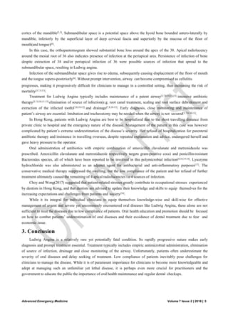 Using a Ludwig Atlas arch without Ludwig Atlas mounts