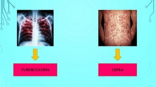 TUBERCULOSIS LEPRA
 