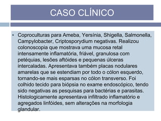 ▪ Coproculturas para Ameba, Yersínia, Shigella, Salmonella,
Campylobacter, Criptosporydium negativas. Realizou
colonoscopia que mostrava uma mucosa retal
intensamente inflamatória, friável, granulosa com
petéquias, lesões aftóides e pequenas úlceras
intercaladas. Apresentava também placas nodulares
amarelas que se estendiam por todo o cólon esquerdo,
tornando-se mais esparsas no cólon transverso. Foi
colhido tecido para biópsia no exame endoscópico, tendo
sido negativas as pesquisas para bactérias e parasitas.
Histologicamente apresentava infiltrado inflamatório e
agregados linfóides, sem alterações na morfologia
glandular.
CASO CLÍNICO
 