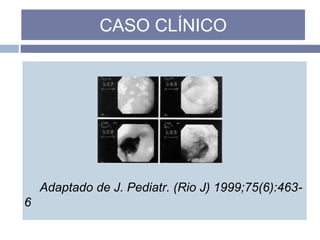 Adaptado de J. Pediatr. (Rio J) 1999;75(6):463-
6
CASO CLÍNICO
 