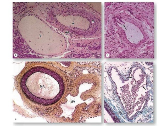 Histology Of Blood Vessels Histology Of Blood Vessels