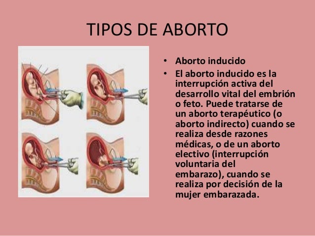 Imagen relacionada