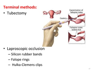 PHYSIOLOGY OFCONTRACEPTION | PPTX