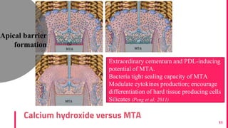 Calcium hydroxide versus MTA
11
Apical barrier
formation
Extraordinary cementum and PDL-inducing
potential of MTA.
Bacteria tight sealing capacity of MTA
Modulate cytokines production; encourage
differentiation of hard tissue producing cells
Silicates (Peng et al; 2011)
 