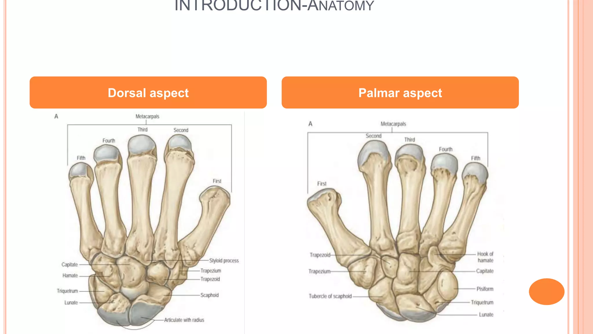 Scaphoid fracture | PPTX
