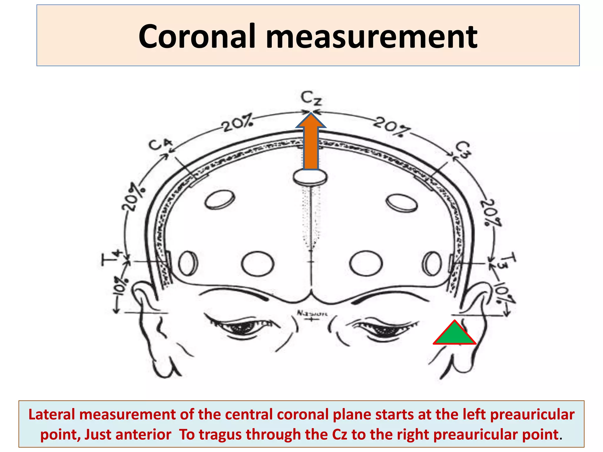 10 20 system of eeg | PPTX