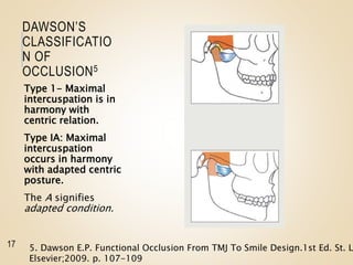 DAWSON’S
CLASSIFICATIO
N OF
OCCLUSION5
Type 1- Maximal
intercuspation is in
harmony with
centric relation.
Type IA: Maximal
intercuspation
occurs in harmony
with adapted centric
posture.
The A signifies
adapted condition.
17 5. Dawson E.P. Functional Occlusion From TMJ To Smile Design.1st Ed. St. L
Elsevier;2009. p. 107-109
 