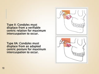 Type II: Condyles must
displace from a verifiable
centric relation for maximum
intercuspation to occur.
Type IIA: Condyles must
displace from an adapted
centric posture for maximum
intercuspation to occur.
18
 