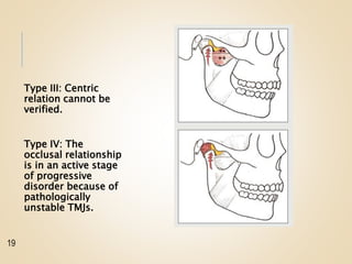 Type III: Centric
relation cannot be
verified.
Type IV: The
occlusal relationship
is in an active stage
of progressive
disorder because of
pathologically
unstable TMJs.
19
 