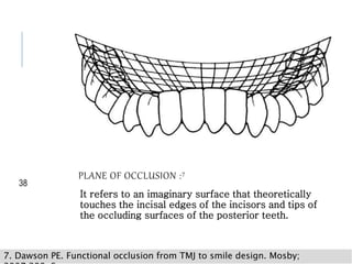 PLANE OF OCCLUSION :7
It refers to an imaginary surface that theoretically
touches the incisal edges of the incisors and tips of
the occluding surfaces of the posterior teeth.
38
7. Dawson PE. Functional occlusion from TMJ to smile design. Mosby;
 