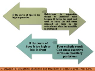 42
7. Dawson PE. Evaluation, diagnosis and treatment of occlusal problems; p.190
If the curve of Spee is too
high in posterior
Deleterious to supporting
tissues of posterior teeth
because it forces the most post
teeth to carry the full stress
imposed on them by the
musculature when the mandible
is protruded
If the curve of
Spee is too high or
low in front
Poor esthetic result
Can cause excessive
stress on maxillary
posteriors
 