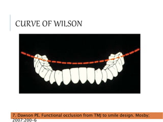 CURVE OF WILSON
43
7. Dawson PE. Functional occlusion from TMJ to smile design. Mosby;
2007:200-6
 