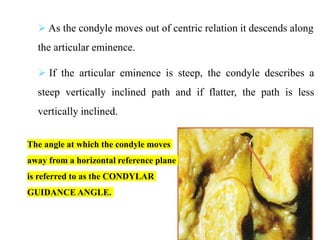  As the condyle moves out of centric relation it descends along
the articular eminence.
 If the articular eminence is steep, the condyle describes a
steep vertically inclined path and if flatter, the path is less
vertically inclined.
The angle at which the condyle moves
away from a horizontal reference plane
is referred to as the CONDYLAR
GUIDANCE ANGLE.
50
 
