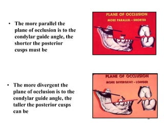 • The more parallel the
plane of occlusion is to the
condylar guide angle, the
shorter the posterior
cusps must be
• The more divergent the
plane of occlusion is to the
condylar guide angle, the
taller the posterior cusps
can be
59
 