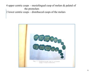 70
4 upper centric cusps - mesiolingual cusp of molars & palatal of
the premolars
2 lower centric cusps – distobuccal cusps of the molars
 