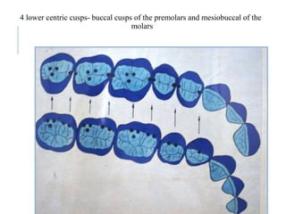 4 lower centric cusps- buccal cusps of the premolars and mesiobuccal of the
molars
73
 