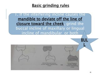 Basic grinding rules
85
1. If the interfering incline causes the
mandible to deviate off the line of
closure toward the cheek, grind the
buccal incline of maxillary or lingual
incline of mandibular or both
BUL
L
 