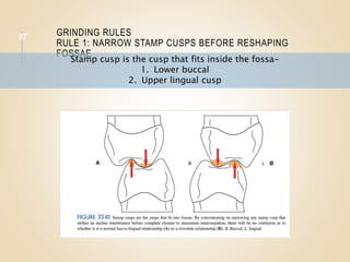 GRINDING RULES
RULE 1: NARROW STAMP CUSPS BEFORE RESHAPING
FOSSAE
87
Stamp cusp is the cusp that fits inside the fossa-
1. Lower buccal
2. Upper lingual cusp
 